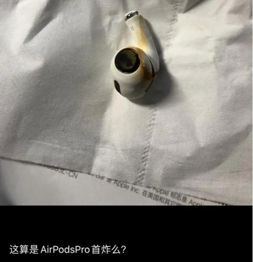 AirPods爆炸？小伙称当场被炸晕 事后耳朵疼听力下降