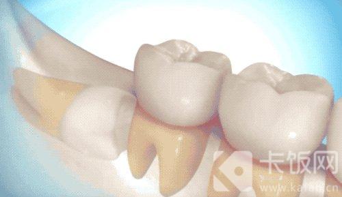 智齿人人都有吗