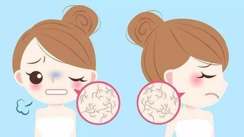 冬季皮肤容易干燥粗糙，主要是因为