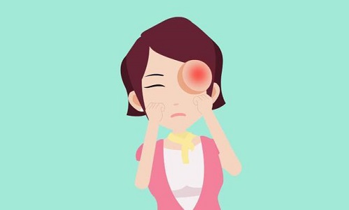 大哭之后眼睛会肿，主要是因为