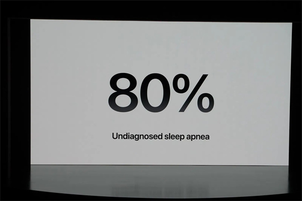 苹果发布 Apple Watch Series 10 智能手表